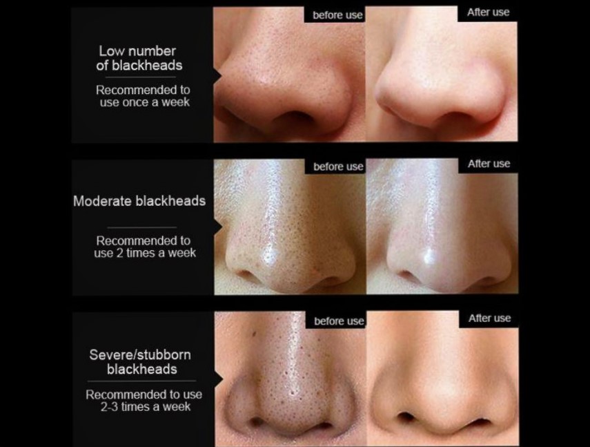 Bamboo Charcoal Mask